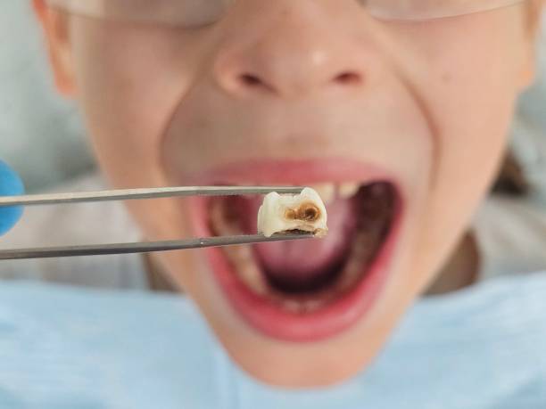 Best Emergency Broken Tooth Repair in Ocean Gate, NJ